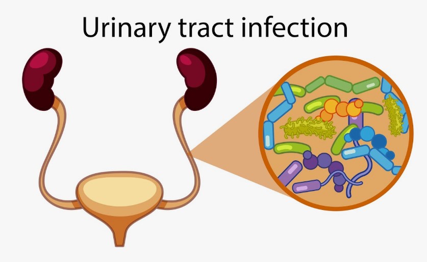 Urine Infection Symptom